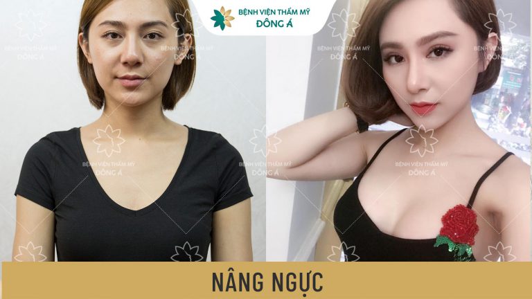 NÂNG NGỰC TÚI NANO – CHUẨN SIZE, TRÒN DÁNG, CẢM GIÁC NHƯ THẬT